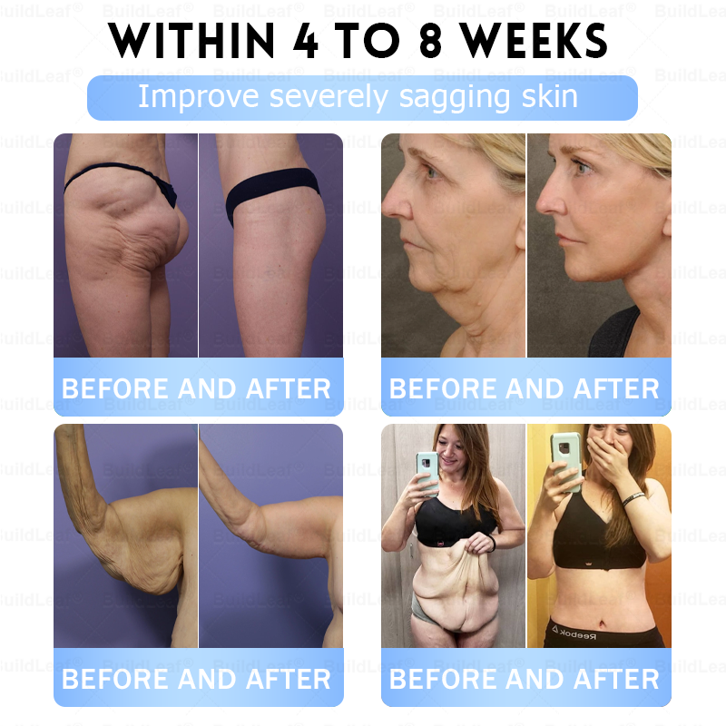 One last chance! Grab this lucky find at 70% OFF!🔥   𝐵uil𝗱𝐿ea𝐟®